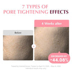 Collagen Pore