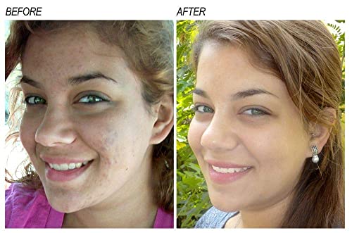 Vitamin C Serum for Face (1 Fl Oz (Pack of 1))