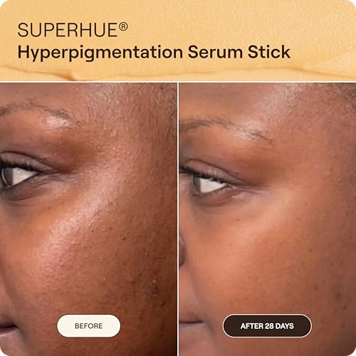 Superhue Hyperpigmentation Serum Stick Mini (Mini Serum Stick)