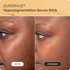 Superhue Hyperpigmentation Serum Stick Mini (Mini Serum Stick)