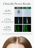 Rosemary Scalp Scaling Shampoo for Hair Growth (01. Rosemary 1 Pack)