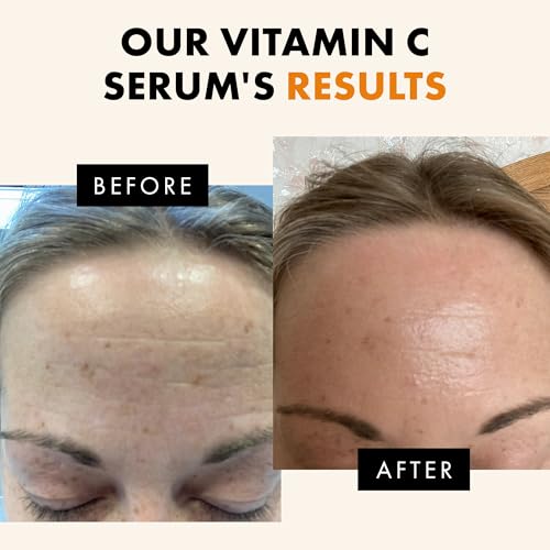 Vitamin C Serum (1 Fl Oz (Pack of 1))