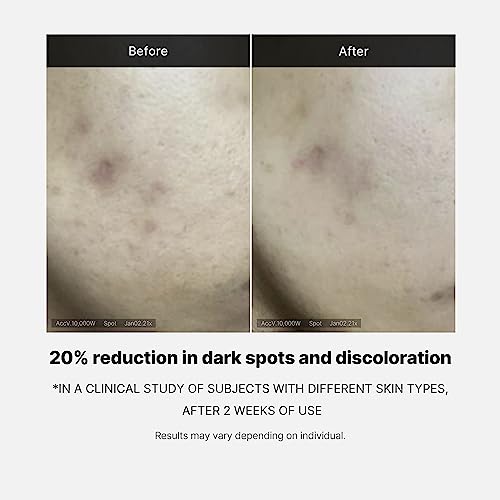 Deep Vita C Serum 2.0 (0.35 Fl Oz (Pack of 3))