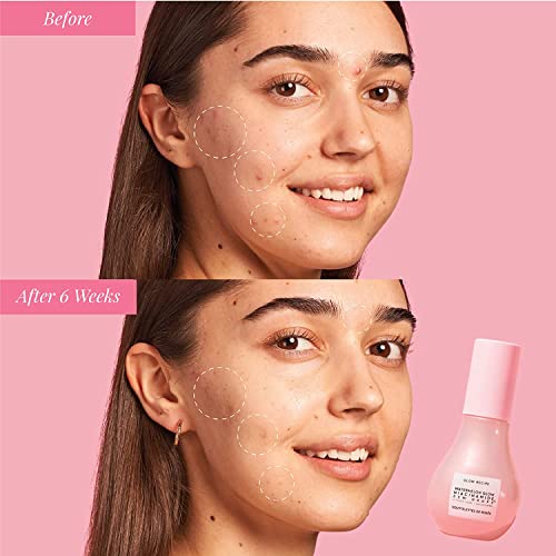 Watermelon Niacinamide Dew Drops (Travel / 0.51 Fl Oz (Pack of 1))