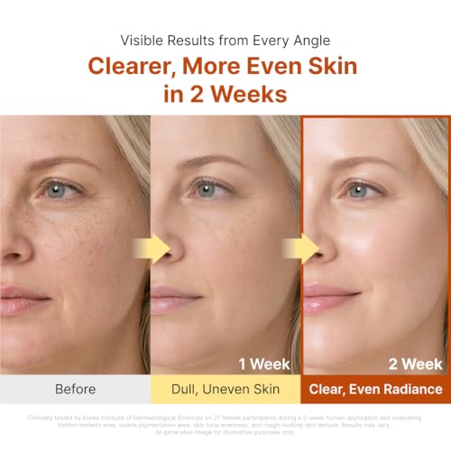 Kojic Acid Capsule Cream (Kojic)