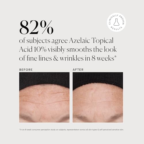 Azelaic Topical Acid 10% Jumbo (2 Ounce (Pack of 1))