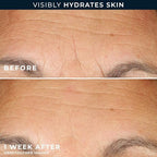 Hyaluronic Acid Night Serum Capsules 30ct + RoC Retinol Capsules 7ct (Hyaluronic Acid Serum Capsules)