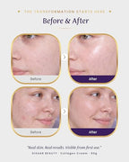 Collagen Cream for Face and Neck (2.8 Ounce (Pack of 1))