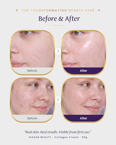 Collagen Cream for Face and Neck (2.8 Ounce (Pack of 1))