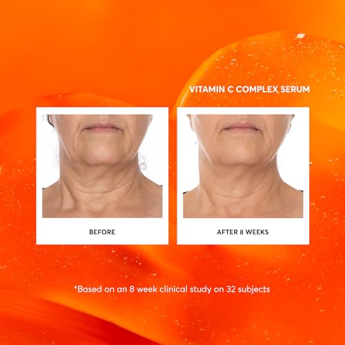 Vitamin C Complex Serum (2 Ounce (Pack of 1))