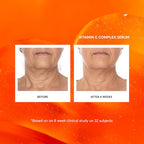 Vitamin C Complex Serum (2 Ounce (Pack of 1))