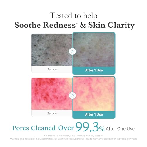 Facial Cleanser Azelaic Acid Whip Cleanser (4.23 Ounce)