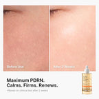 PDRN Vitamin C Serum Toning Ampoule JUMBO SIZE (2.36 Fl Oz (Pack of 1))