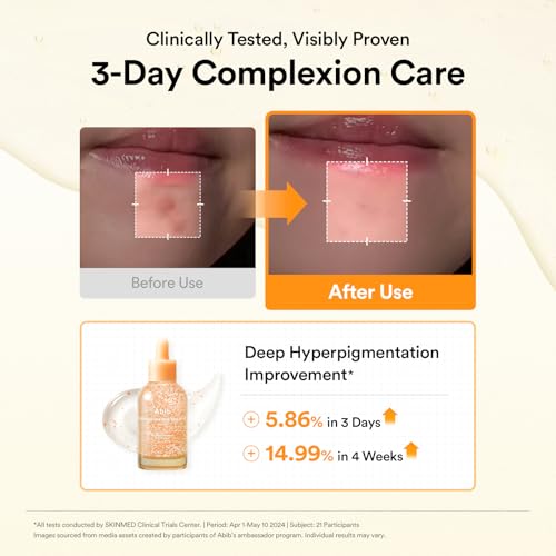 Glutathiosome Dark Spot Serum Vita drop 1.69 fl.oz (1.69 Fl Oz (Pack of 1))