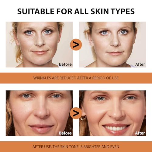 Vitamin C Serum for Face (1.01 Fl Oz (Pack of 1))