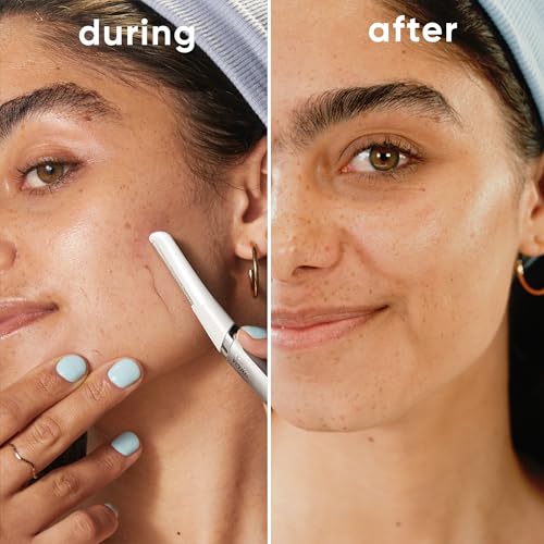 Facial Razor Exfoliating Dermaplaning Tool for Face (Dermaplane Razor + 5 Blades)