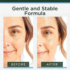 Hyaluronic Acid Serum for Face (2 Fl Oz (Pack of 1))
