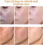 Melanina Anti-Melasma & Dark Kit, Anti-Melasma Serum+Collagen Jelly Cream, Ultra Moisturizer for Women, Supports Even Skin Tone & Radiance (SET)