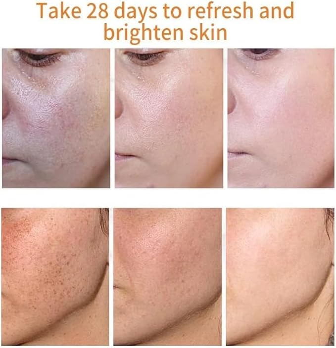 Melanina Anti-Melasma & Dark Kit, Anti-Melasma Serum+Collagen Jelly Cream, Ultra Moisturizer for Women, Supports Even Skin Tone & Radiance (SET)