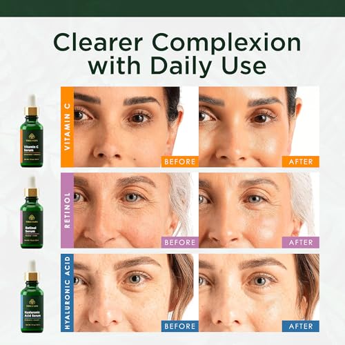 Face Serum Skin Care