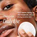 Acne Treatment Pads (60 Count (Pack of 1))