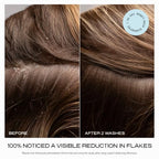 Balancing Shampoo & Nourishing Conditioner for Men & Women (Duo)