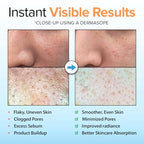 Brightening Peeling Gel with Cellulose (4.02 Fl Oz (Pack of 2))