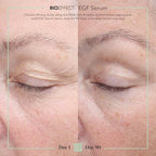 EGF Serum Age (0.5 Fl Oz (Pack of 1))