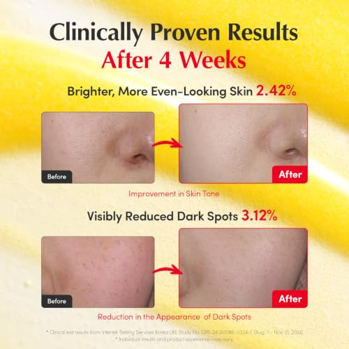 Vitamin Illuminating Serum Double Pack (2 Pack / 1.01 Fl Oz (Pack of 2))