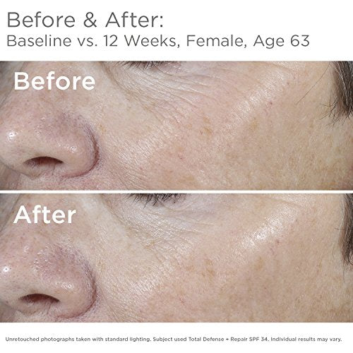 Total Defense + Repair SPF 34 Sunscreen for Face. This Lightweight (2.3 Ounce (Pack of 1) / Total Defense)