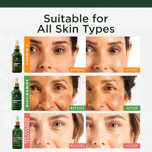 Face Serum Skin Care Set