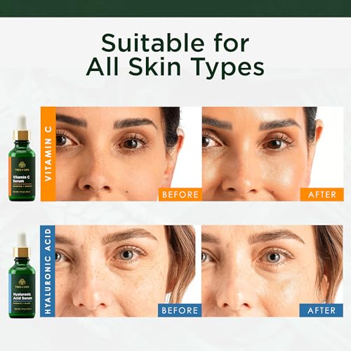 Face Serum Skin Care
