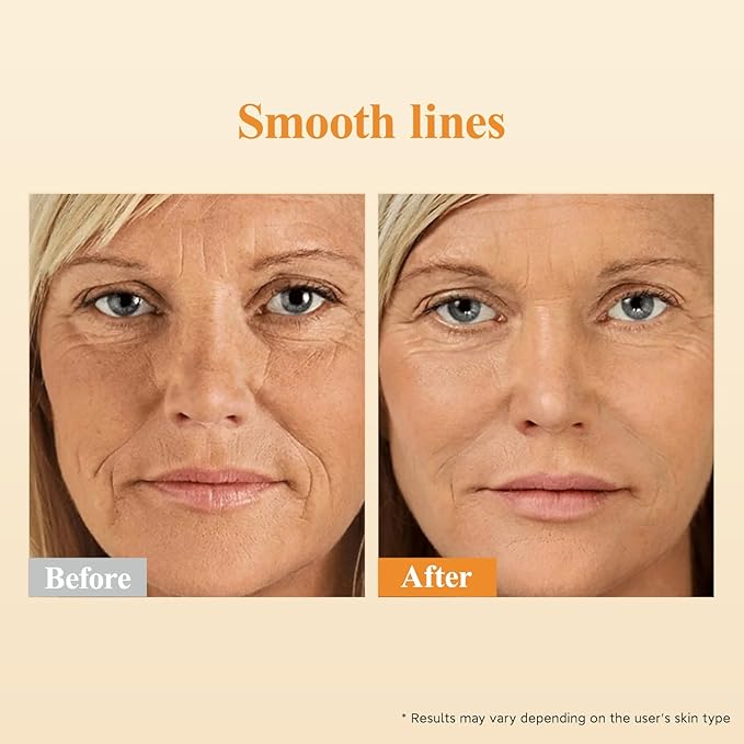Triple Retinol Serum for Face - Anti-Aging Wrinkle Night Retinol +HPR Capsules, Peptide Serum for Women, Reduce Fine Lines, Tighten Sagging Skin Vitamin A