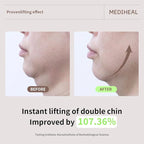Mediheal Retinol Collagen Cream Lifting Mask (4 Counts) for V Line Mask,Anti-Aging - Helps Reduce Fine Lines & Wrinkles, and Smoothens Skin