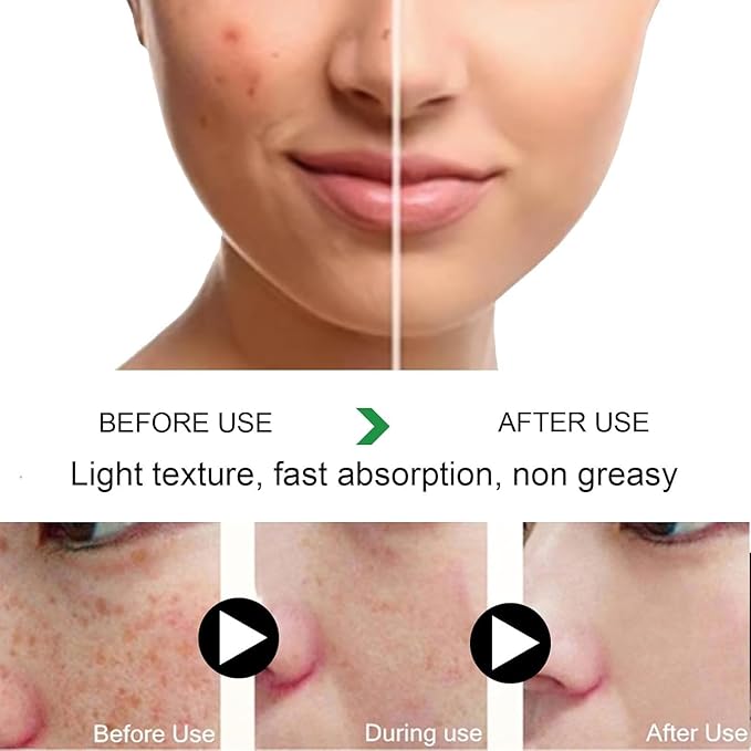 Melanina Anti-Melasma & Dark Kit, Anti-Melasma Capsules - with DIM, Turmeric Extract 95% for Women, Supports Even Skin Tone & Radiance 60 Capsules (1)