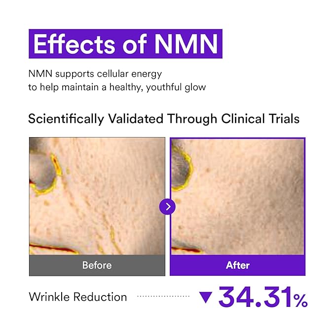 NMN Collagen Cream | Hydrating & Firming Moisturizer with Peptides & Glutathione & Hyaluronic Acid | Boosts Elasticity & Wrinkle Care | Korean Skincare, 1.69 fl.oz