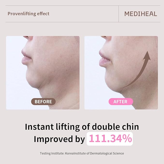 Mediheal Retinol Collagen Ampoule Lifting Mask (4 Counts) for V Line Mask Anti-Aging - Helps Reduce Fine Lines & Wrinkles, and Smoothens Skin