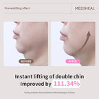 Mediheal Retinol Collagen Ampoule Lifting Mask (4 Counts) for V Line Mask Anti-Aging - Helps Reduce Fine Lines & Wrinkles, and Smoothens Skin