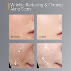 60 Day Type I & III Collagen Face Serums,Anti-Aging Wrinkle,Daily Line Smoothing Skin Care Treatment for Fine Lines, Post-Acne Scars | 3% Squalane + jojoba oil, 60 Individual Capsules