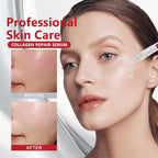 KOEC Collagen Repair Serum for Face 30PCS,Ultra Hydrating Anti-Aging Serum for Women,Moisturising & Boosting & Firming Lightweight
