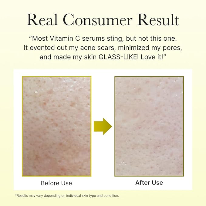 Arencia Vitamin C Booster Shot Serum with Glutathione, Niacinamide and Vitamin E for Dark Spot Care, Fine Lines & Wrinkles, Glass Skin, Korean Skincare 30ml/1.01 fl.oz (Pack of 2)