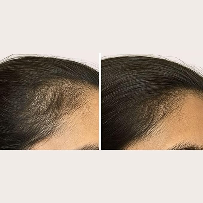Solaris Laboratories NY Intensive Hair Stimulating Brush