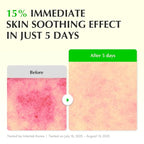 EQQUALBERRY Aloe PDRN Calming Smoothie Serum – Soothing Korean Skin Care for Sensitive Skin, Cica & Aloe for Repair, Hydrating & Radiant Glow, Non-Comedogenic (1.01oz / 30ml)