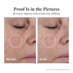 Triple Vitamin C Dark Spots Correction Capsules Serum For Face,Camellia VE Anti-Aging Essence For Women To Tighten Sagging Skin And Reduce Fine Lines Niacinamide serum For Women