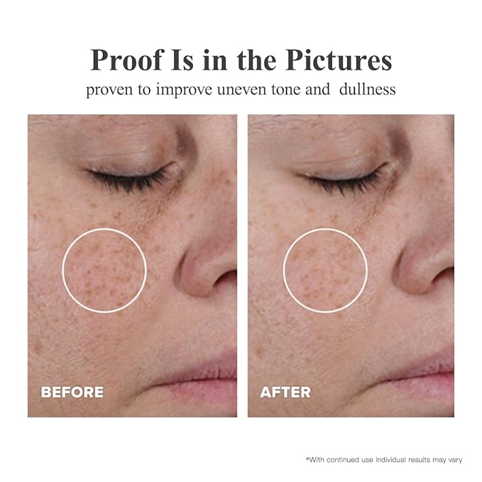 Triple Vitamin C Dark Spots Correction Capsules Serum For Face,Camellia VE Anti-Aging Essence For Women To Tighten Sagging Skin And Reduce Fine Lines Niacinamide serum For Women