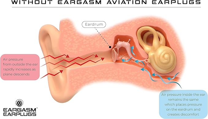 Eargasm Aviation Earplugs - Image 6