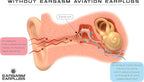 Eargasm Aviation Earplugs - Image 6
