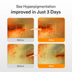 Abib Glutathiosome Dark Spot Serum Vita drop 1.69 fl.oz. | Korean Skincare, Dark Spot, Hyperpigmentation Treatment | Serum for Sensitive, Uneven Skin