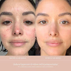 Summer Fridays CC Me Serum with Vitamin C + Niacinamide - Brightening + Hydrating Face Serum to Improve Skin Tone + Reduce Appearance of Dark Spots Over Time (1 Fl Oz)