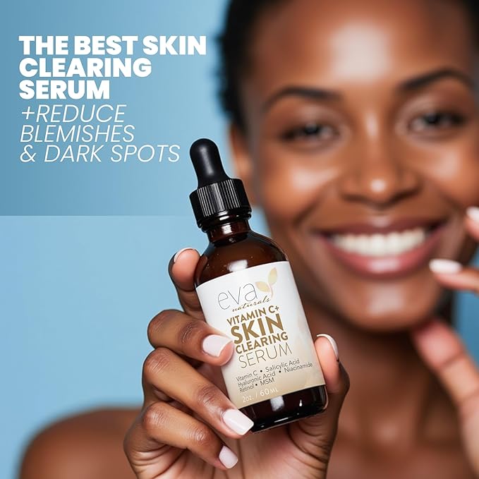 Vitamin C Serum for Face with Retinol & Salicylic Acid – Skin Clearing Acne Spot Treatment with Niacinamide, Hyaluronic Acid, MSM – Anti-Aging Facial Serum for Dark Spots and Blemishes, 2 Fl Oz